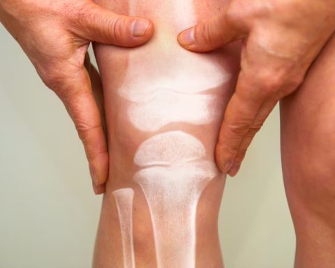 El calcio es un mineral que interviene en la formación y el mantenimiento de huesos