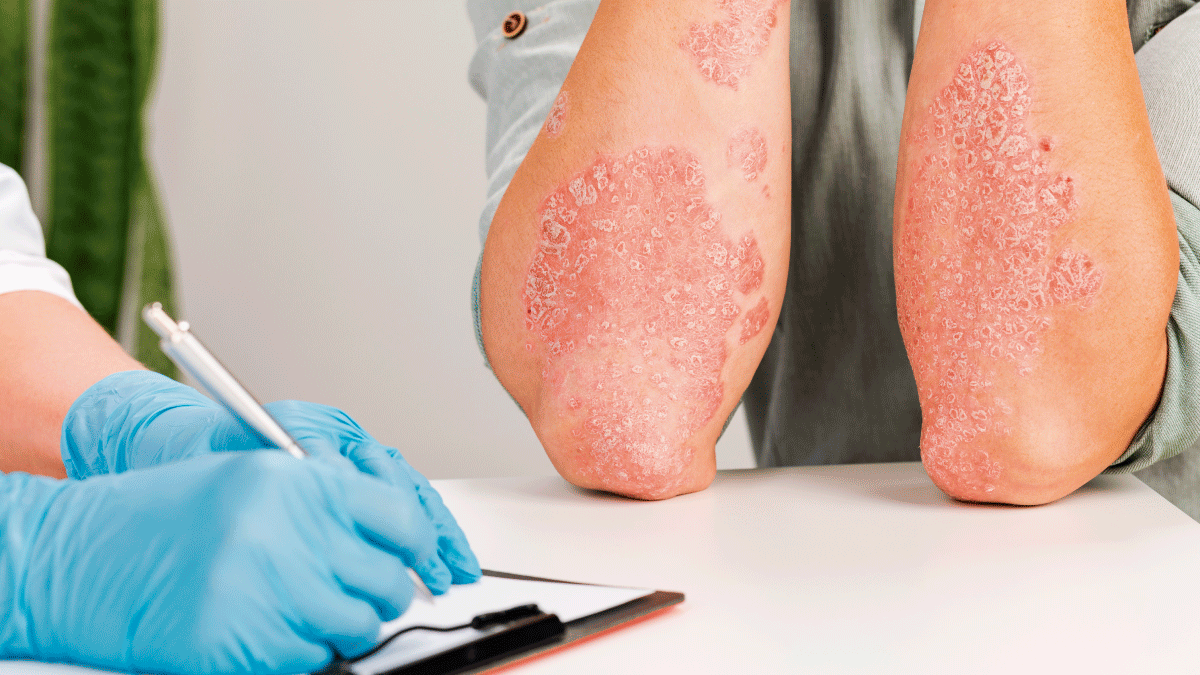 Los especialistas pueden emitir tratamientos por varias vías