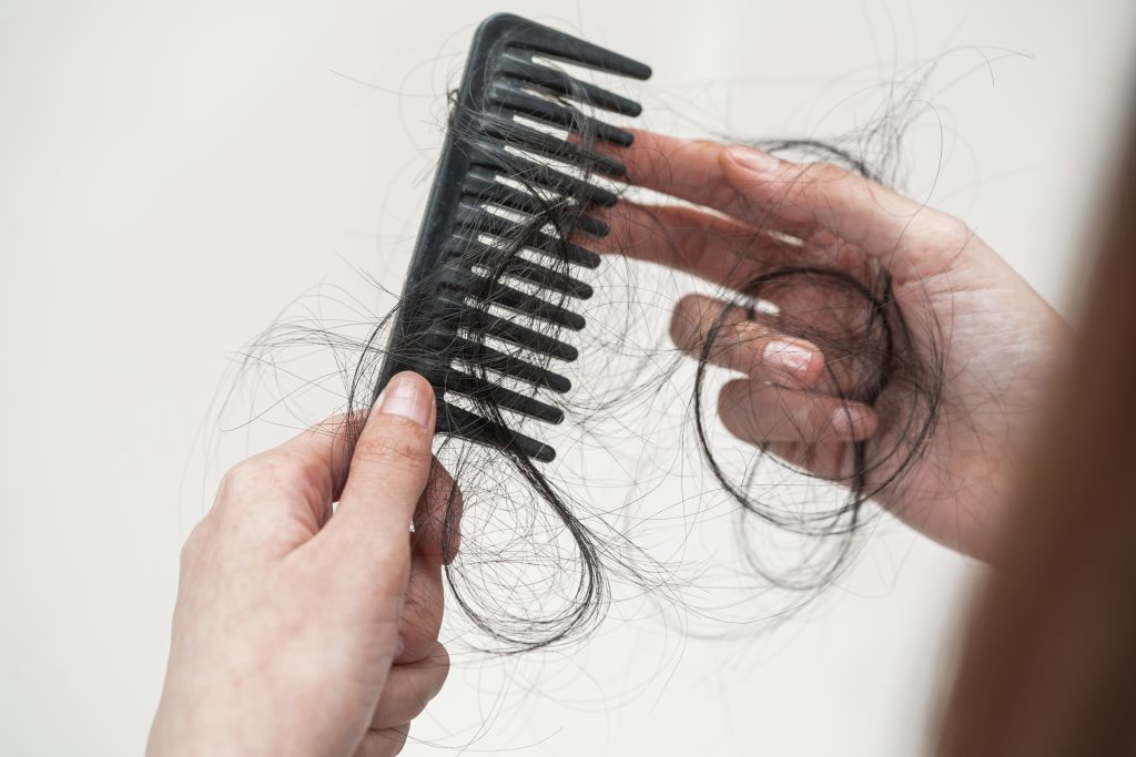 Los problemas de salud mental pueden llevar a la pérdida de cabello