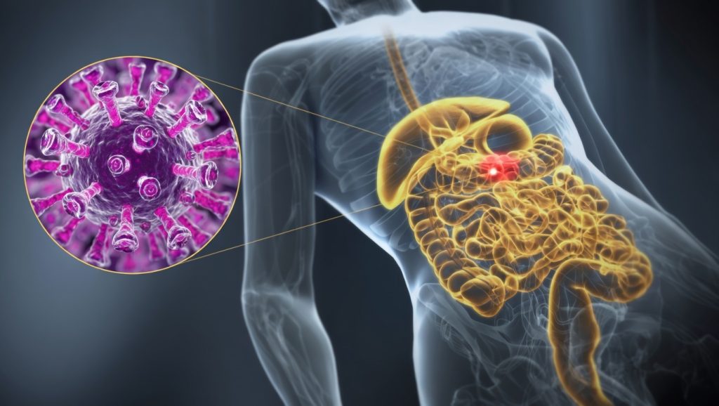  Este virus afecta directamente el estómago e intestinos