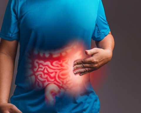La colitis es una afección caracterizada por la inflamación del colon