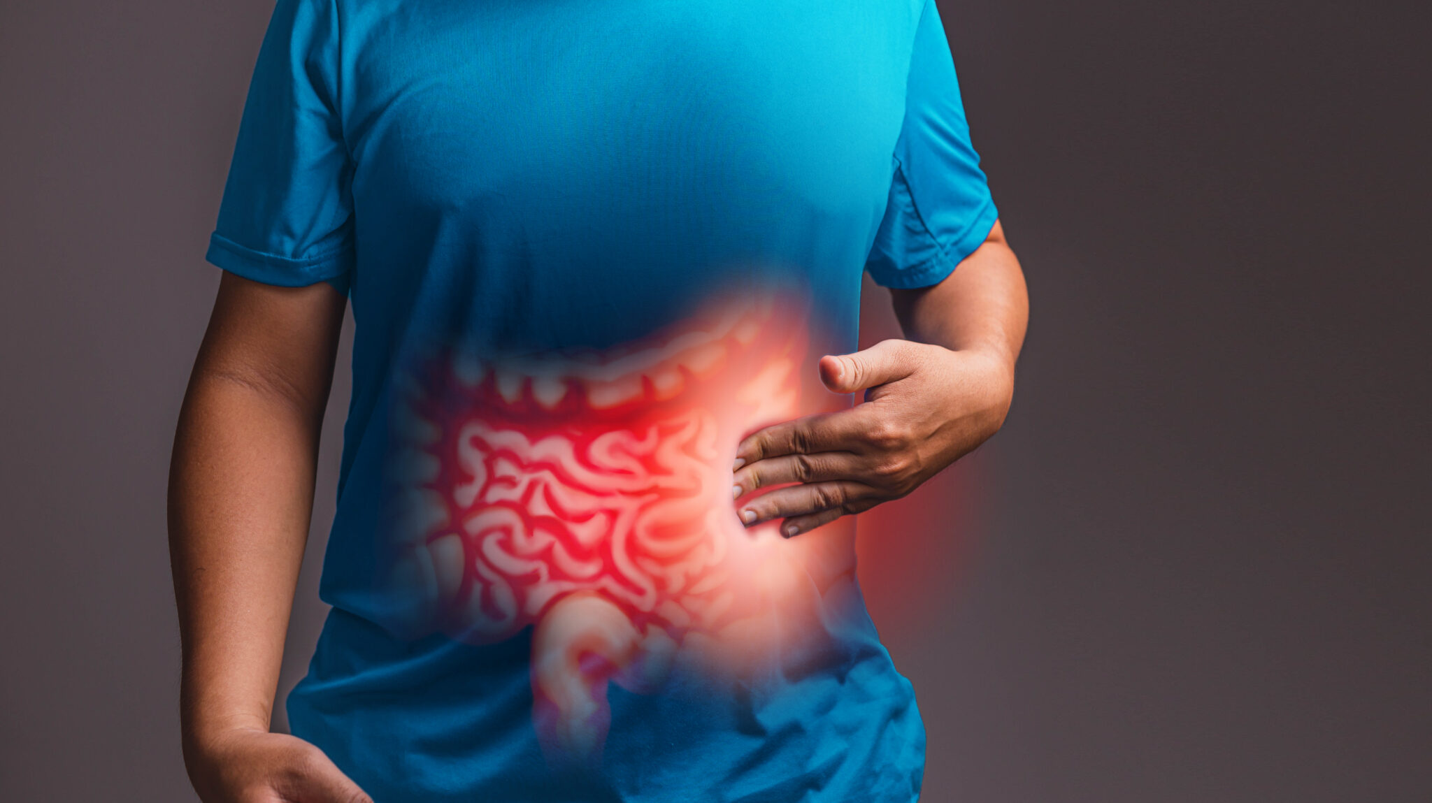 La colitis es una afección caracterizada por la inflamación del colon