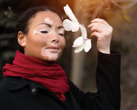 Aproximadamente el 1% de la población mundial padece esta condición