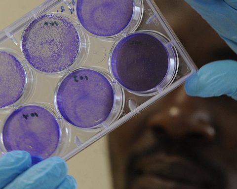 Una zoonosis es una enfermedad o infección que se transmite de forma natural desde los animales a los seres humanos