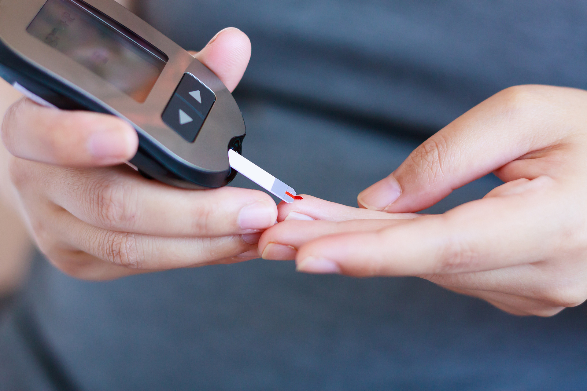 La diabetes tipo 2 es una enfermedad crónica que afecta la forma en que el cuerpo regula el azúcar en sangre